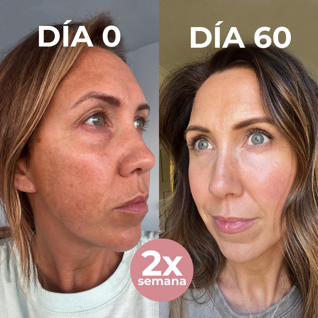 REJUVENECE TU PIEL CON LA MASCARILLA DE BIO-COLÁGENO